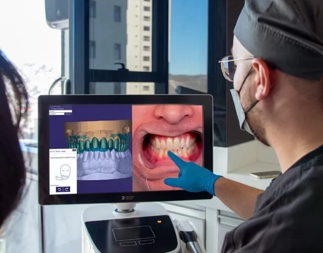 Software de Diseño de Sonrisa